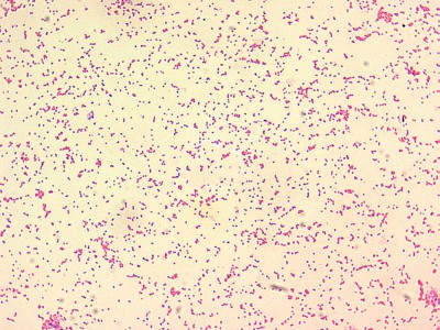 Brucella_spp