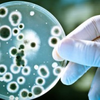 http://www.observatorulph.ro/lifestyle/43806-cat-de-periculoasa-este-infectia-cu-candida