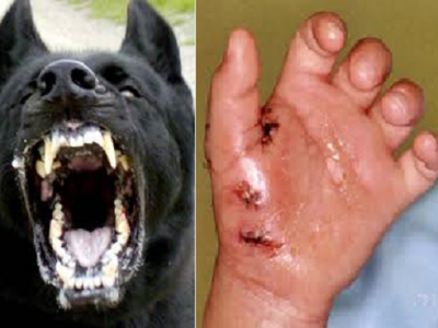 https://www.google.co.id/search?q=anjing+gila&tbm=isch&tbs=simg:CAQSiAEahQELEKjU2AQaAAwLELCMpwgaYApeCAMSKKMP2g_1vEZIP2w-vD5oP6RGRD4YFkDqsJPkpjzr6JIk63SmZOqsknDoaMJ1zwv9P2Hau87PPtSJprtMkCZxNnO74zMt4xjYZ55bxINSmCSmFnmmsBCp_1R2fyaQwLEI6u_1ggaCgoICAESBP4nyHgM&sa=X&ei=C_YhVeaXK4jiuQSQh4HoDw&ved=0CBcQwg4oAA&biw=678&bih=531#imgrc=PbPftsbTWgF_1M%253A%3BVHSCLajkSRk2pM%3Bhttp%253A%252F%252Fiklanbiz.steprofit.com%252Fimage%252Fanjingila.png%3Bhttp%253A%252F%252Fiklanbiz.steprofit.com%252Fartikel-terbaik%252F21-tips-dan-cara-merawat-sengatan-binatang-berbisa.htm%3B396%3B284