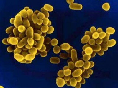 https://rbssinfectiousdiseases.wikispaces.com/Brucellosis