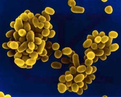 https://rbssinfectiousdiseases.wikispaces.com/Brucellosis