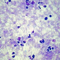 Brucellosis_web
